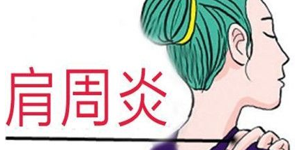 不良習(xí)慣為肩周炎埋下伏筆？玄鹿中頻治療儀