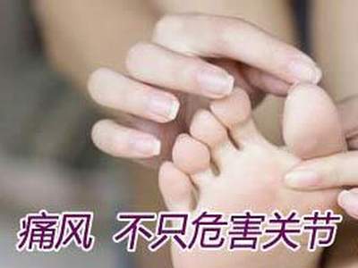 如何確定自己患了痛風