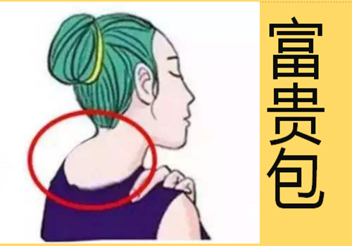 應該如何改善富貴包