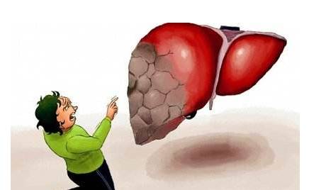 頭部出現(xiàn)這4種狀況，就要注意你的肝了！