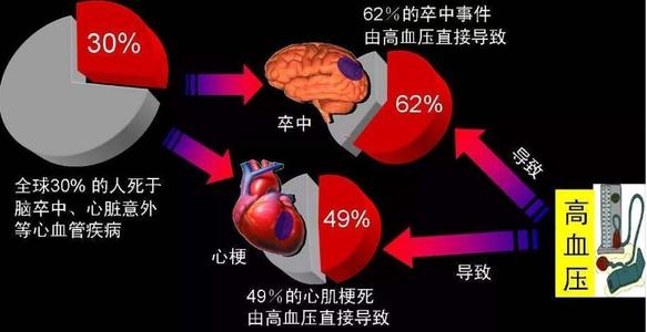 繼發(fā)性高血壓，比原發(fā)性高血壓更加危險(xiǎn)
